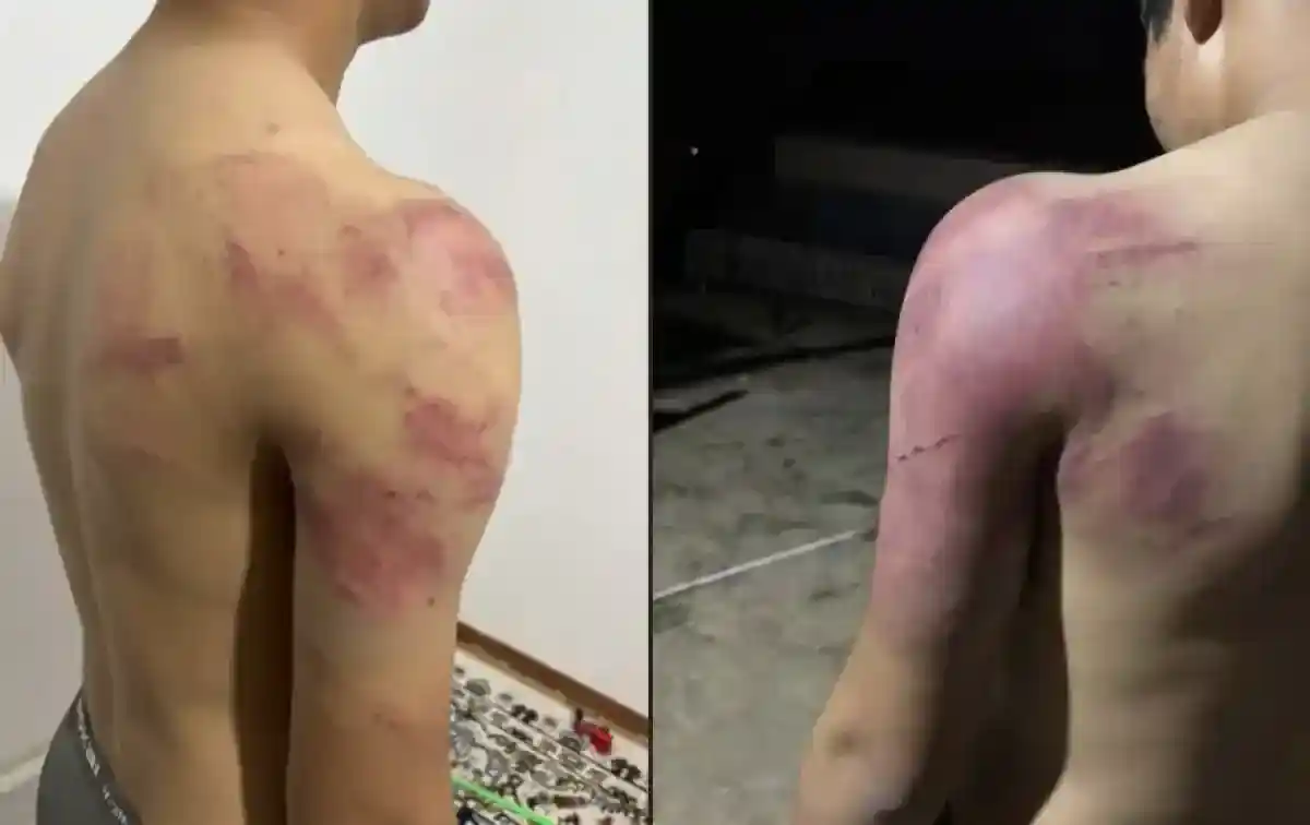 Атырауда екі жасөспірімді жабылып аяусыз соққыға жыққандар ұсталды