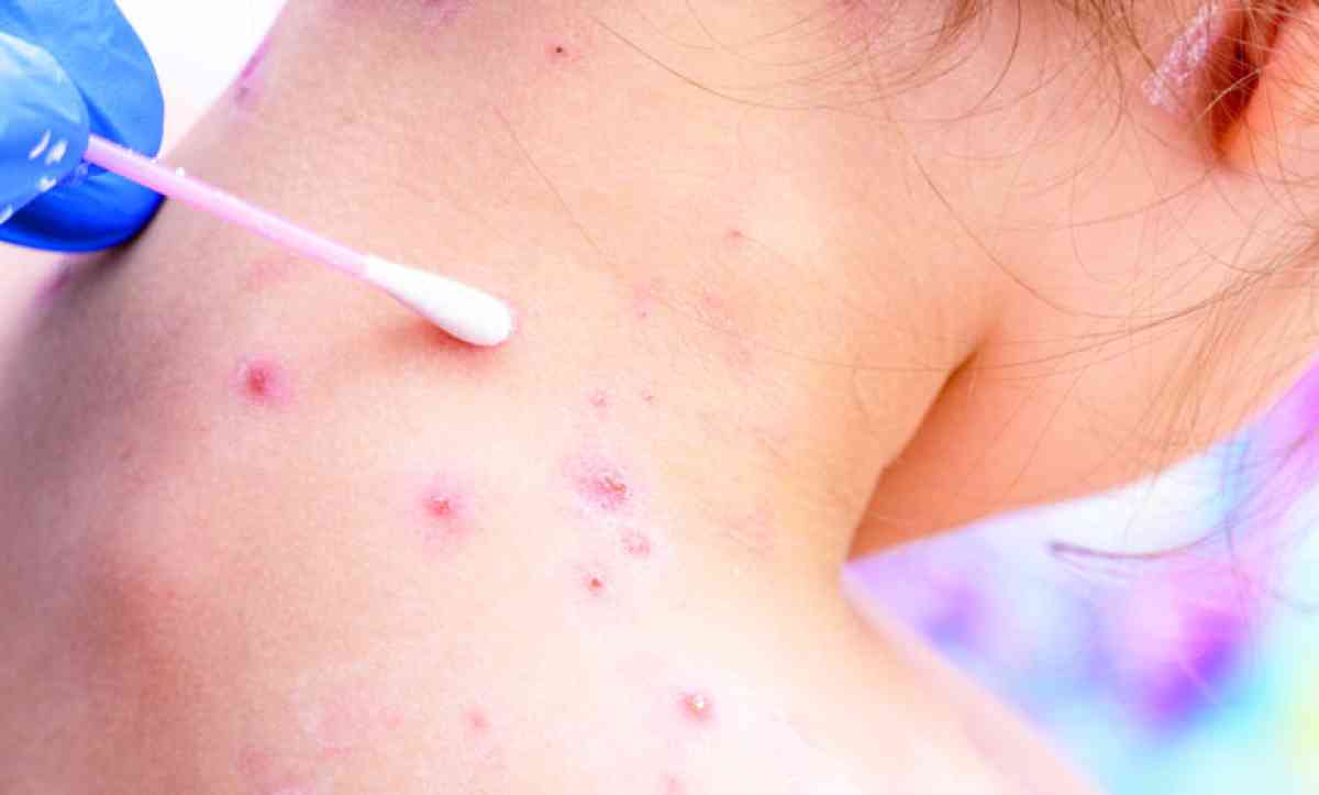 Қызылша қайта белең алып барады