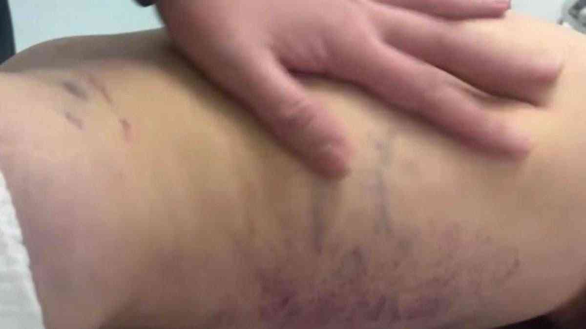 Әкесі аяусыз соққын кішкентай қыздың жағдайы белгілі болды