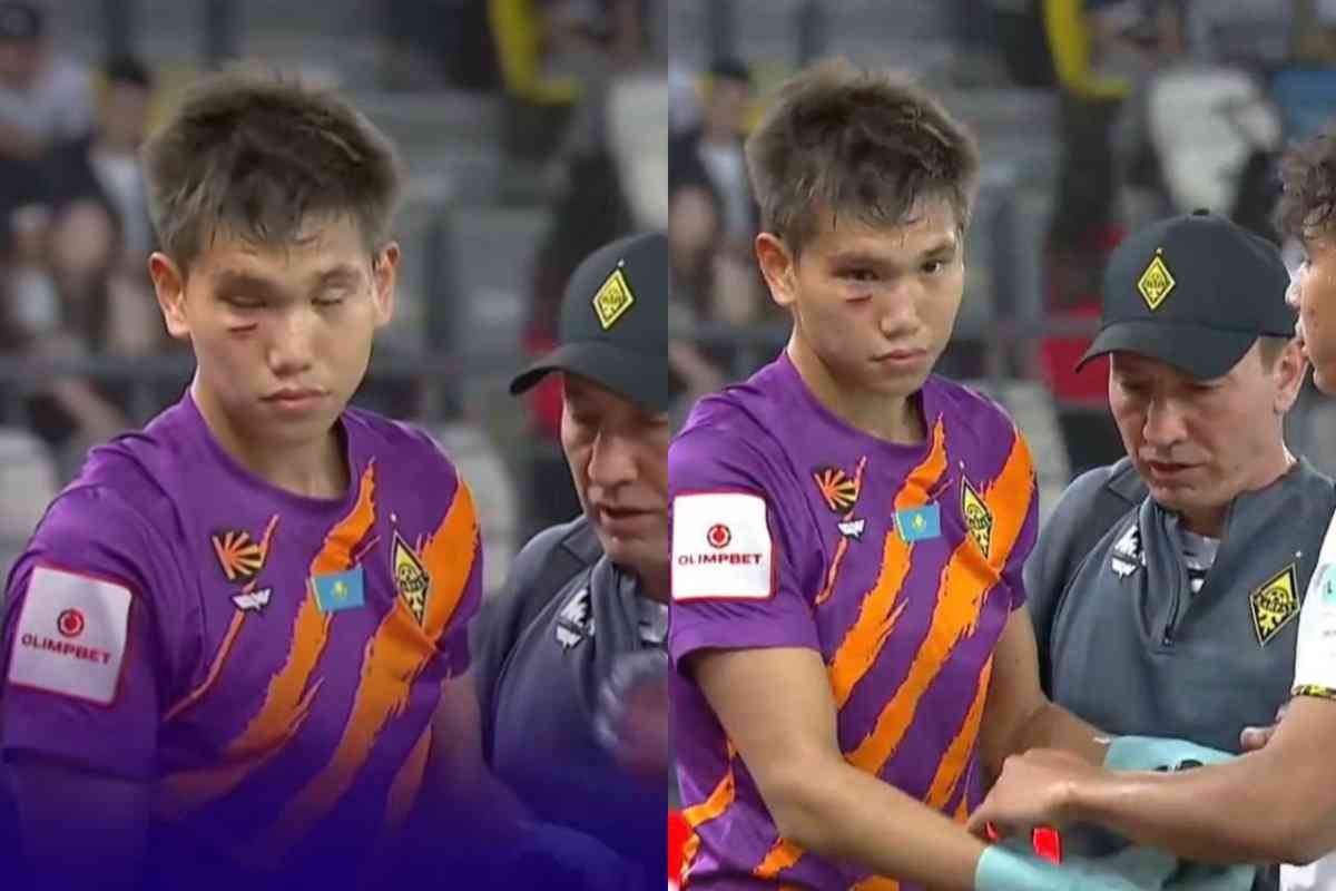 Жұлдызды қақпашы Шерхан Қалмұрза ауыр жарақат алды