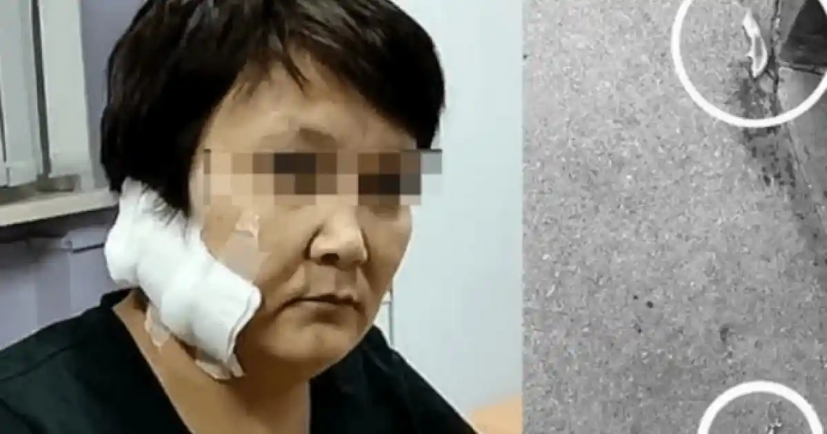 Алты баланың анасы: бұрынғы күйеуі әйелінің құлағын кесіп алған