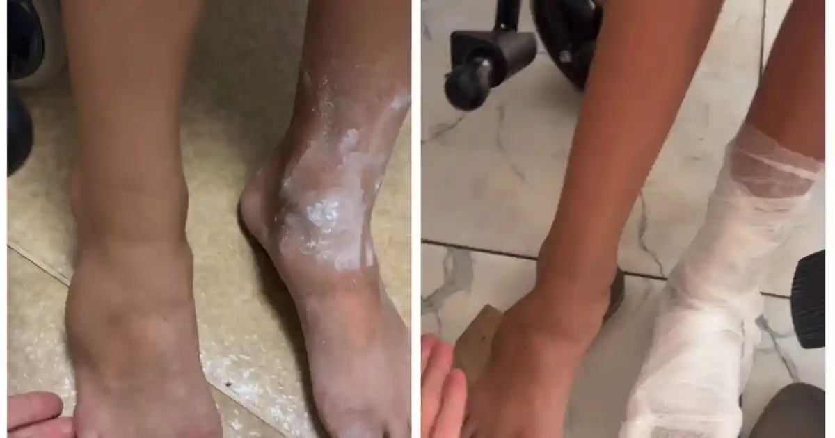Сынбаған аяққа гипс салған: ауруханаға барған келіншек қызық жағдайға тап болғанын жазды